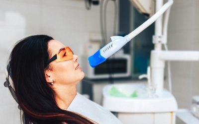 Tooth Whitening and the right questions