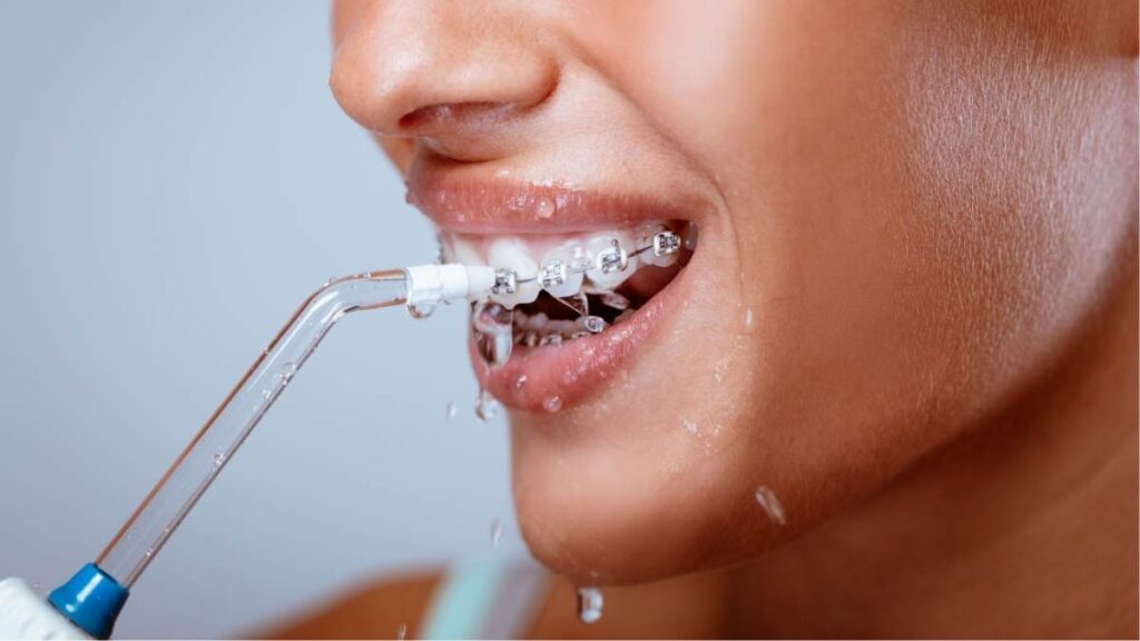 girl holding Invisalign Clear Aligners